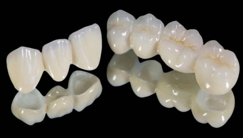 生物陶瓷-钇稳定复合纳米氧化锆发展史